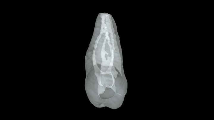 Molar Pulp Chamber Resorption SP 3D Model