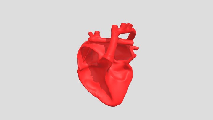 Intracardiac Post Fontan 3D Model