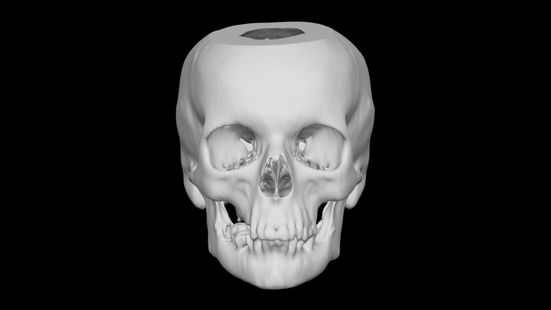 Skull Female 58yo