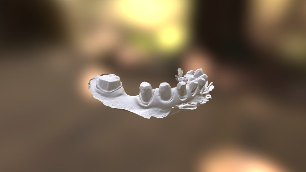 Michael Lower Jaw