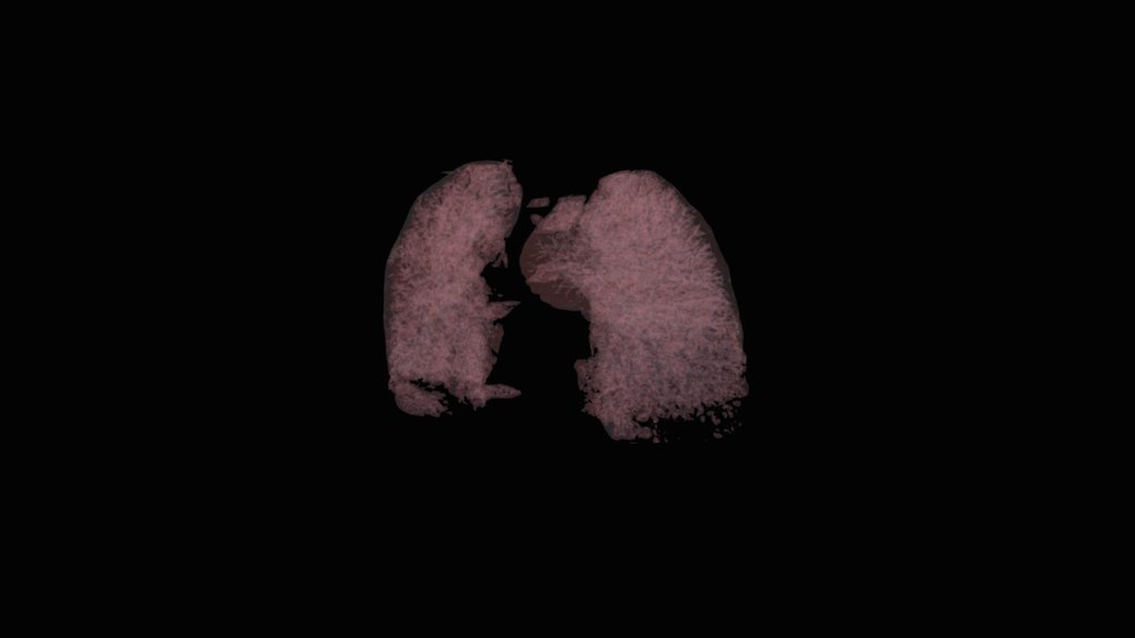 Tissue 2