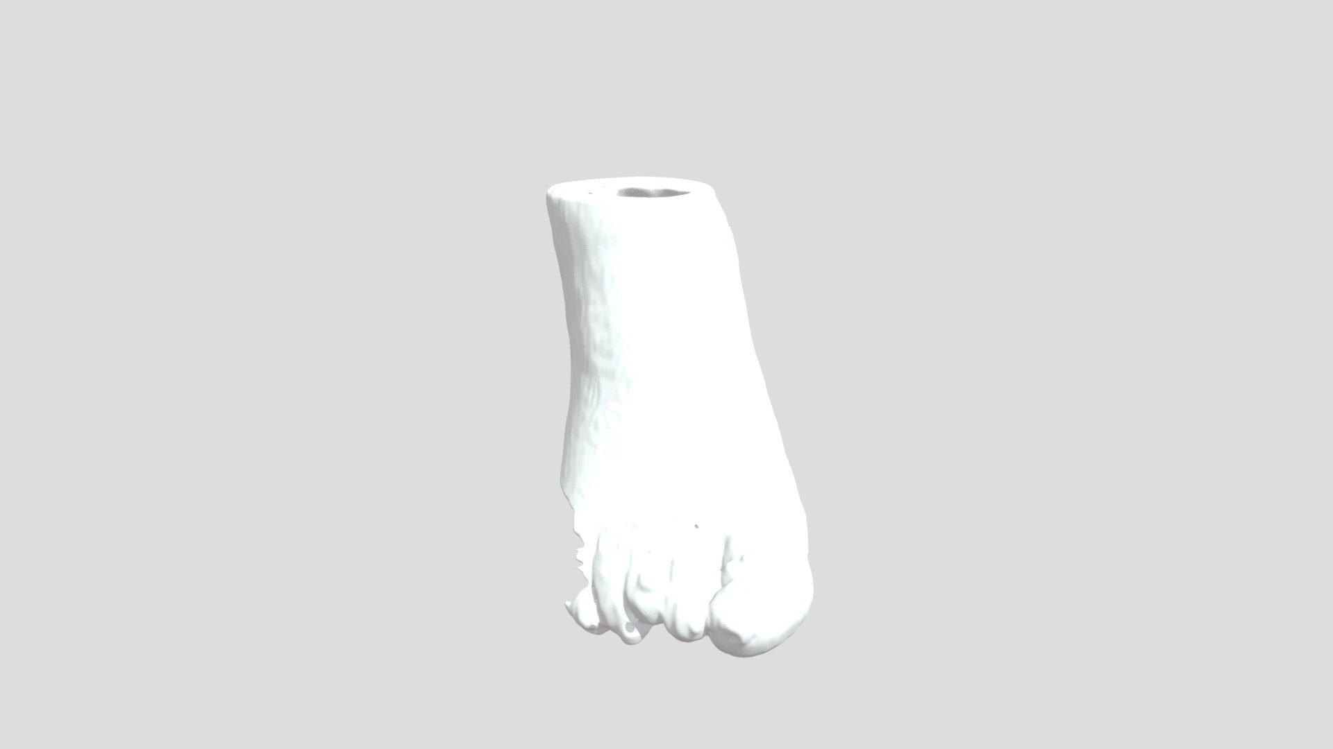Soft tissue