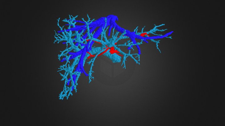 3graft_whole liver 3D Model