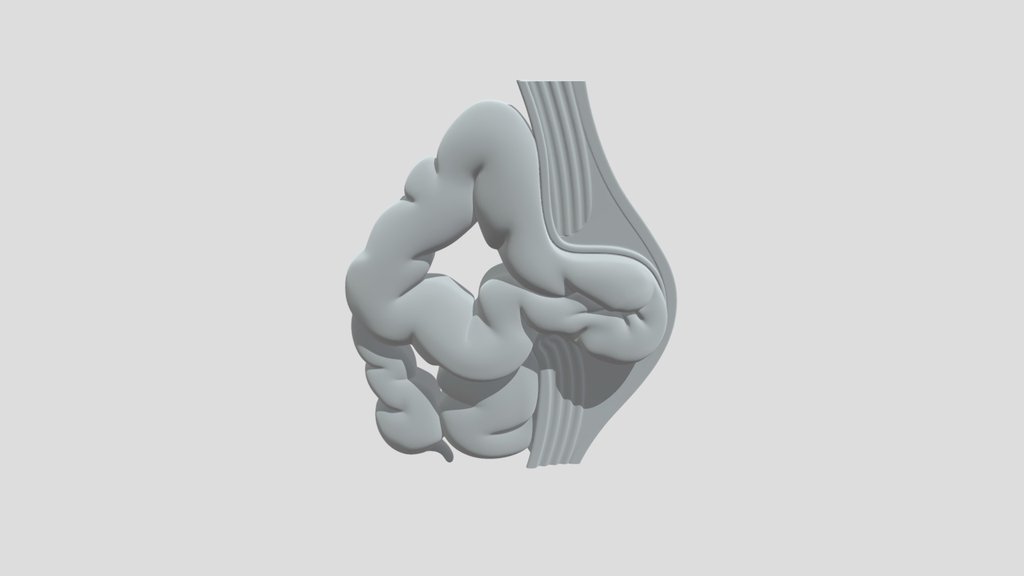 Capas de la pared abdominal con hernia umbilical