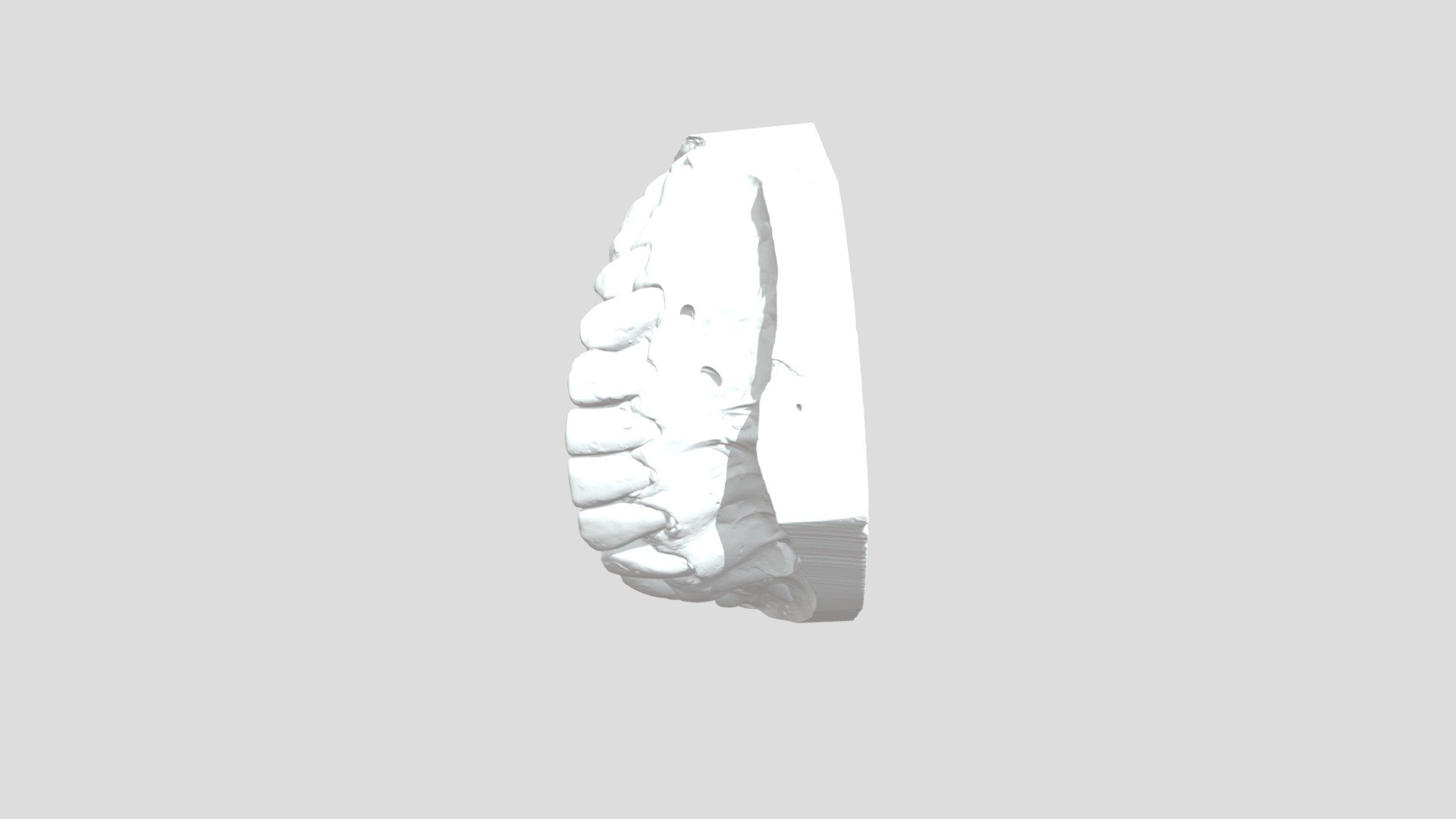 Plaster cast of teeth