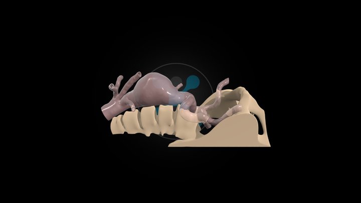 HumanX Medical Case Study #003