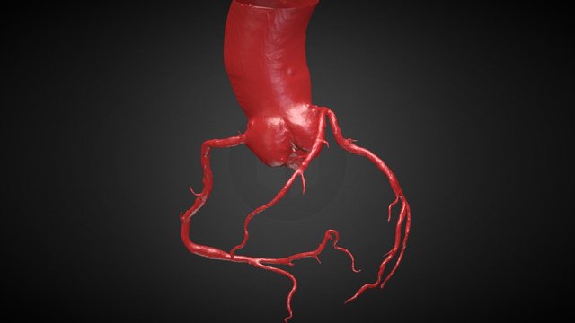 Arterias Coronarias 3D Model