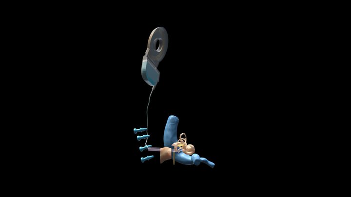 Otoplan set with trajectory 3D Model