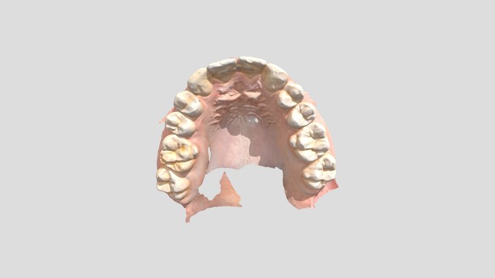 Reto diagnóstico UD8- Arcada maxilar 3D Model