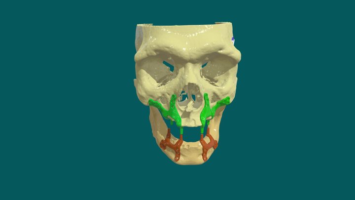 31251435_Alok Mangal 3D Model