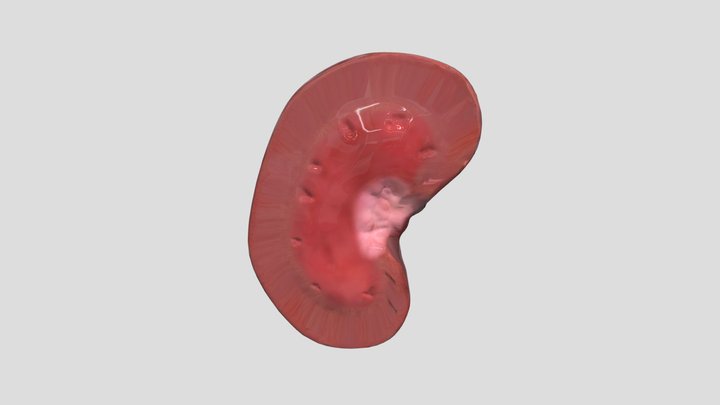 Pulpy Kidneys (Veterinary Pathology) 3D Model