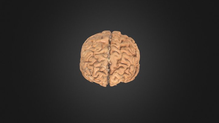 Plastinated Human Brain 3D Model