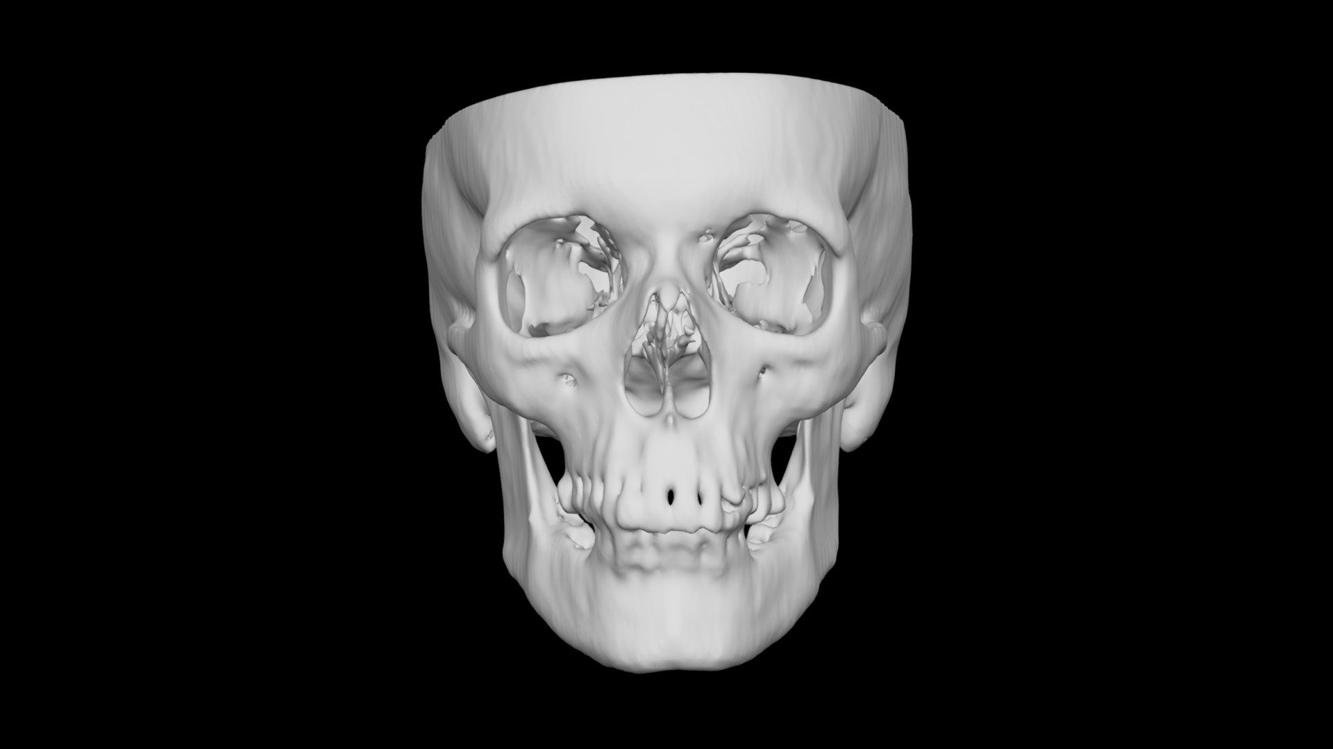 Skull Female 57yo