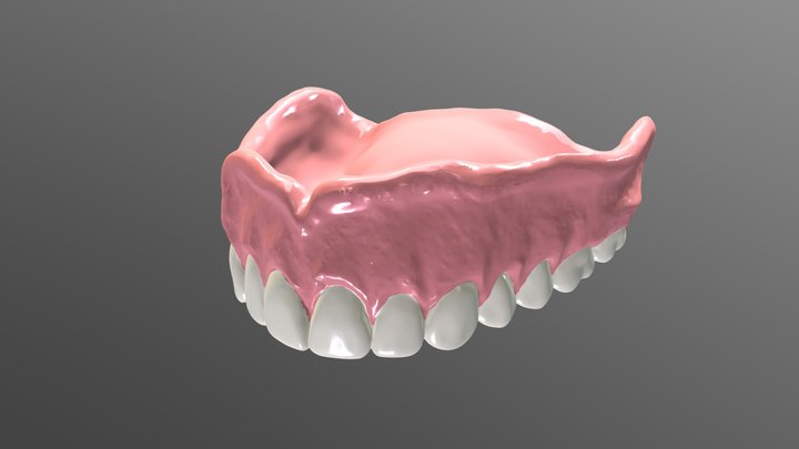 Maxillary Complete Denture - Ernie Wolfe, CDT 3D Model
