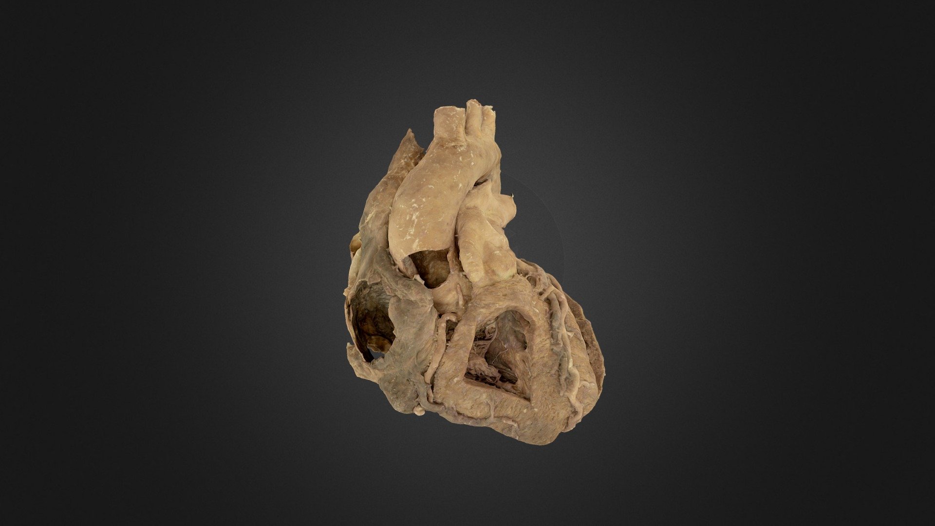Plastinated Human Heart and Aorta