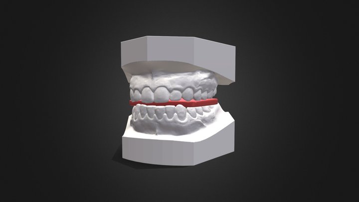 Dental Model with Constructions bite 3D Model