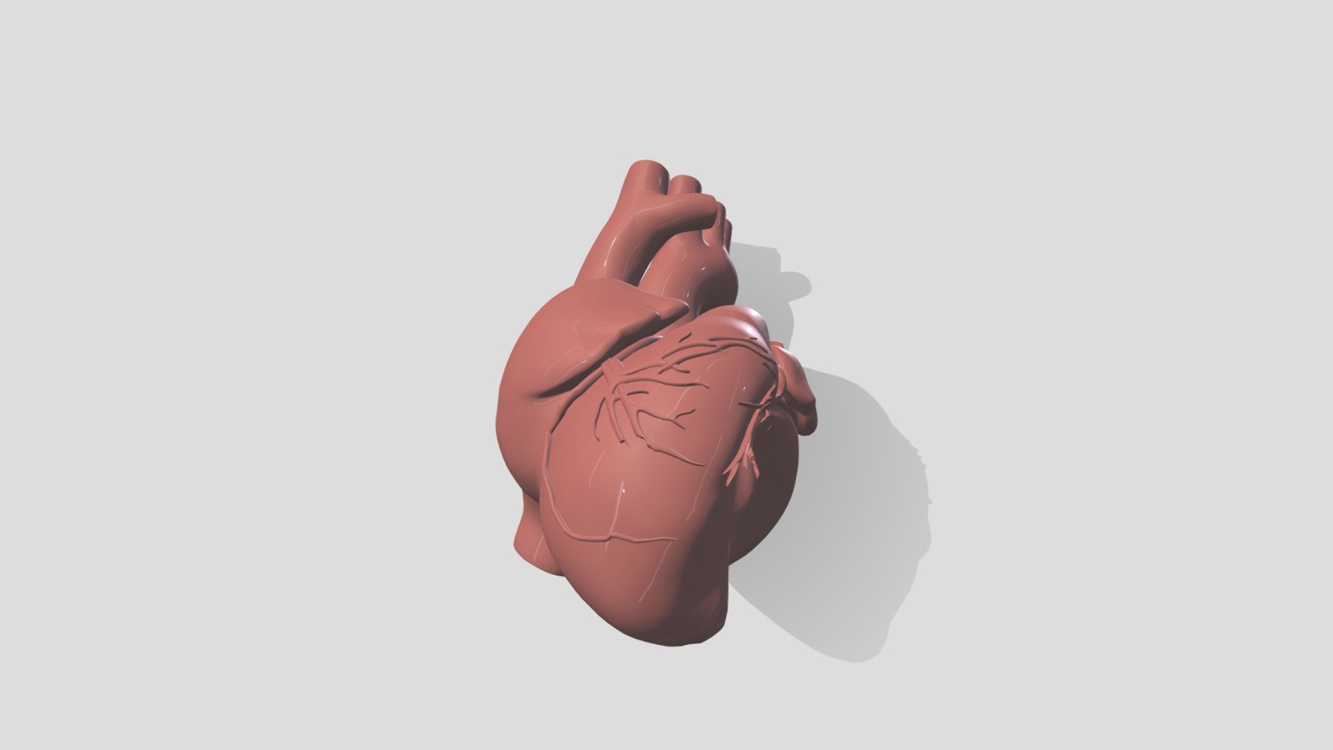 Hypoplastic left heart