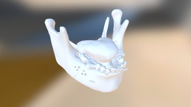IMDO (Before) 3D Model