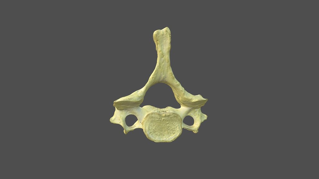 Cervical Vertebra 3 with Texture