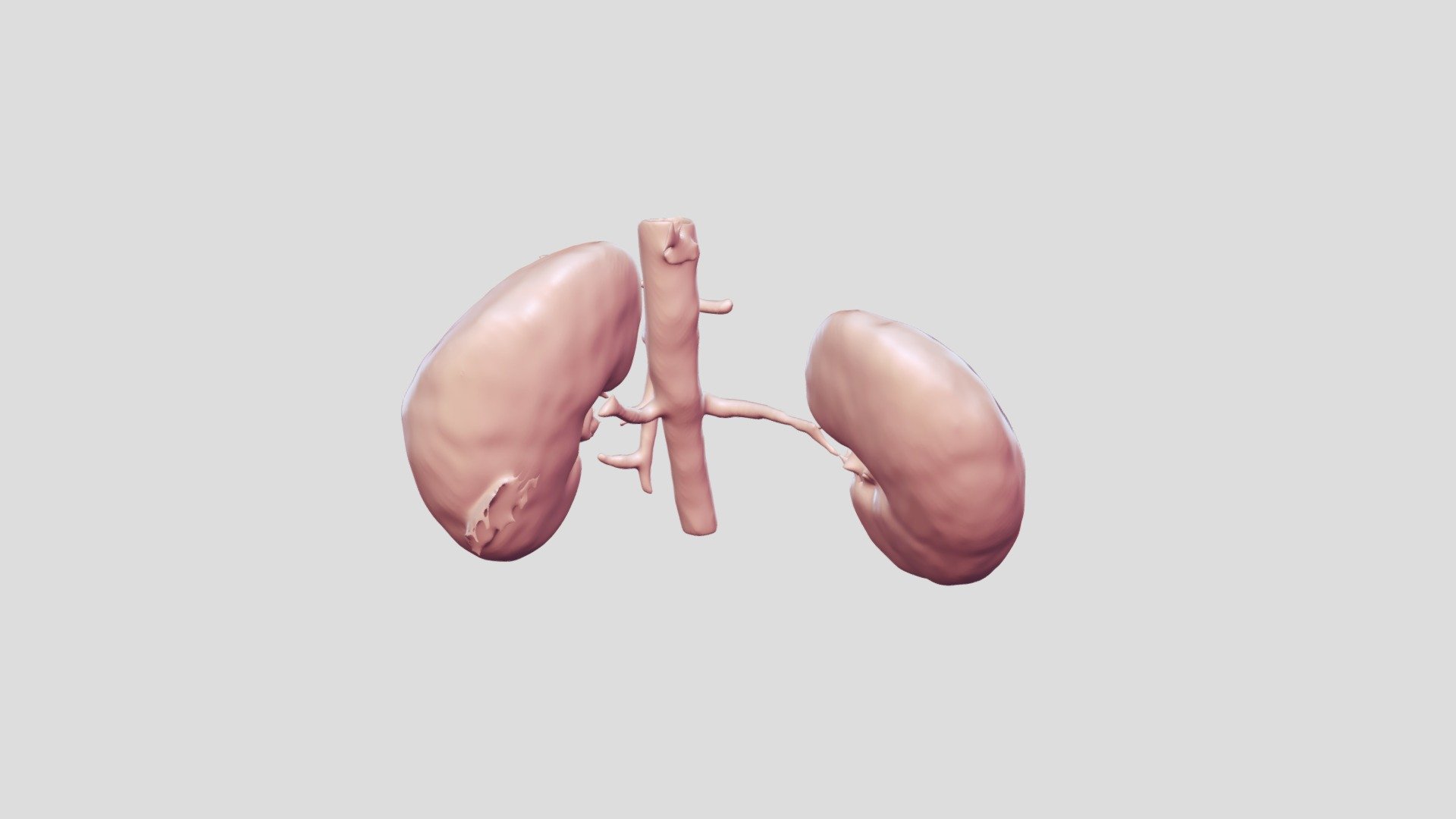 Kidney And Aorta