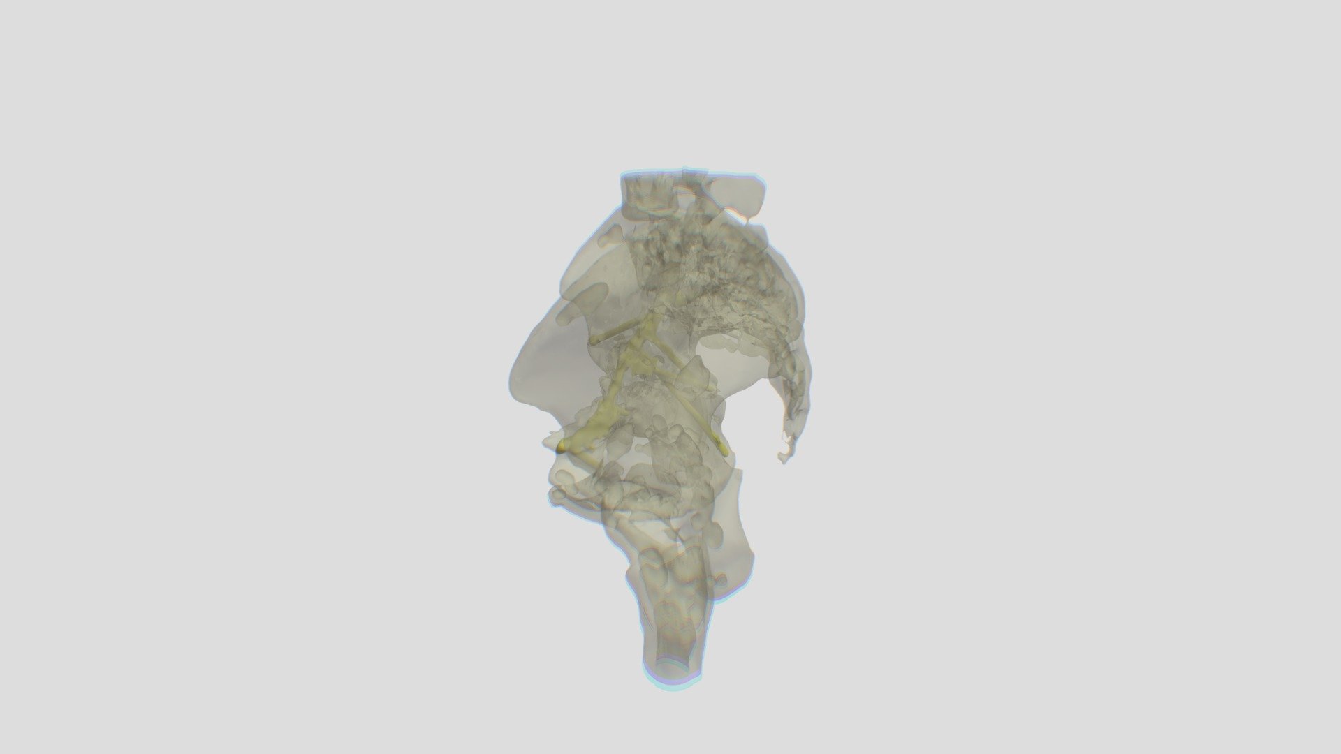 Pelvis And Hardware Exam 3