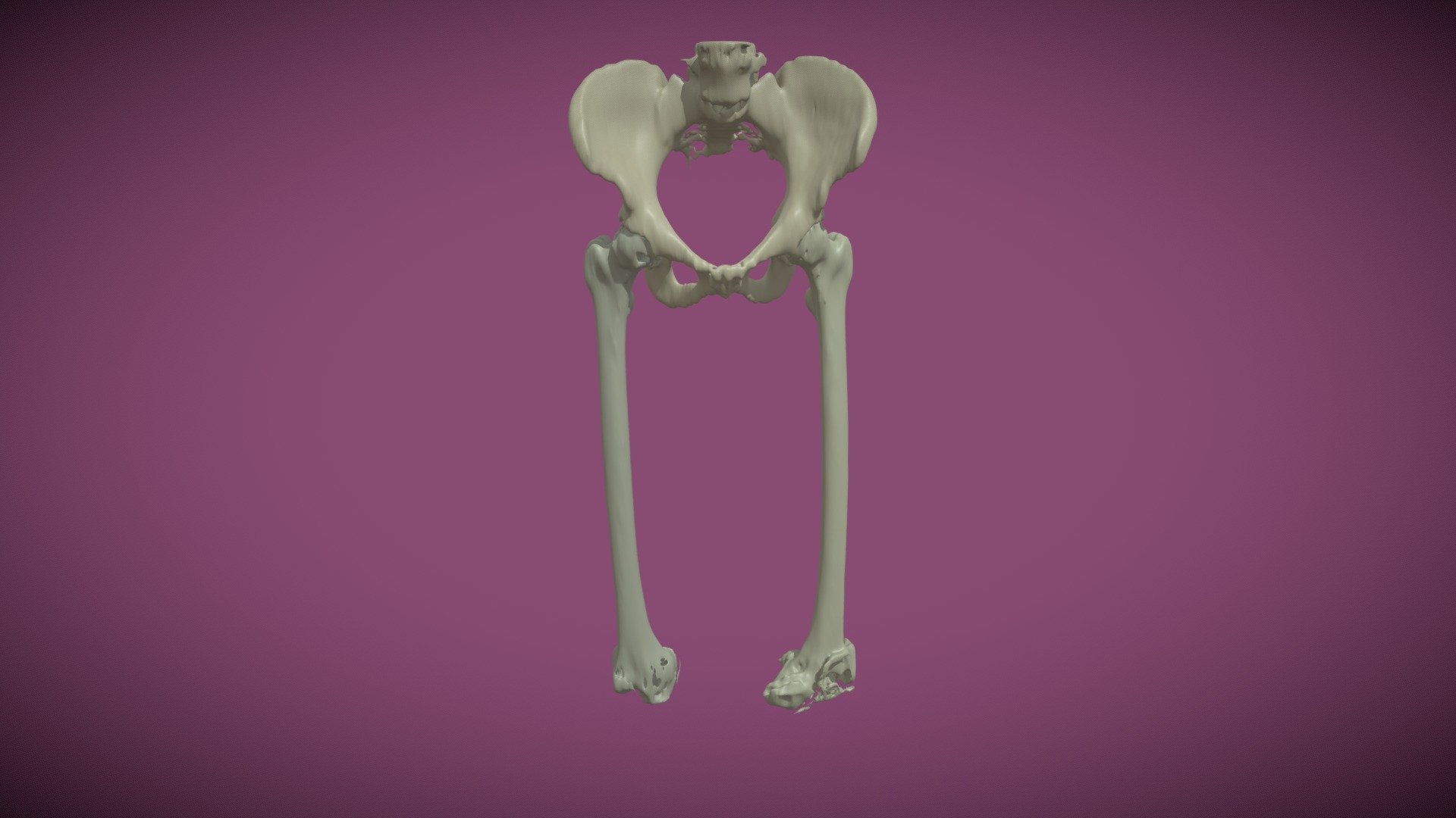 Pelvis and Femurs