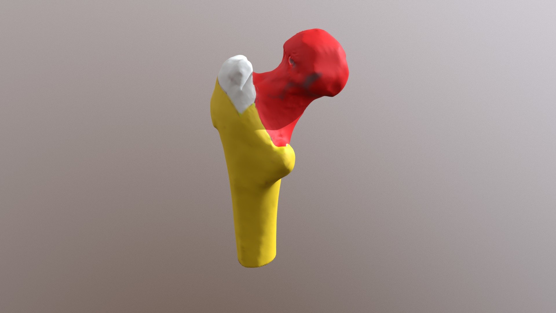 31-PS-692