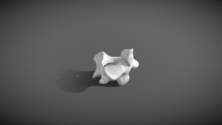 Axis - C2 vertebra 3D Model