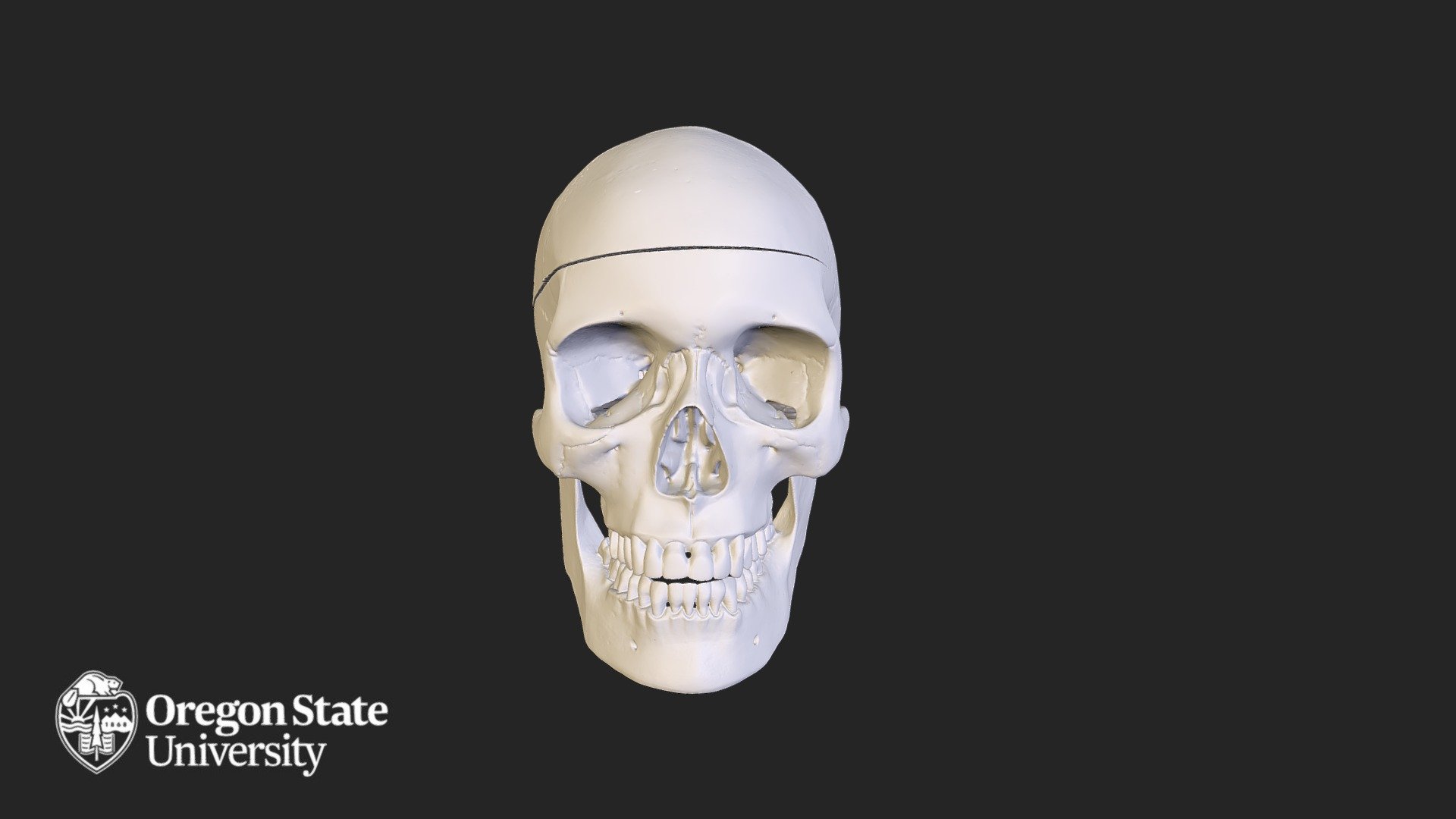 Skull Complete - with Cap and Mandible
