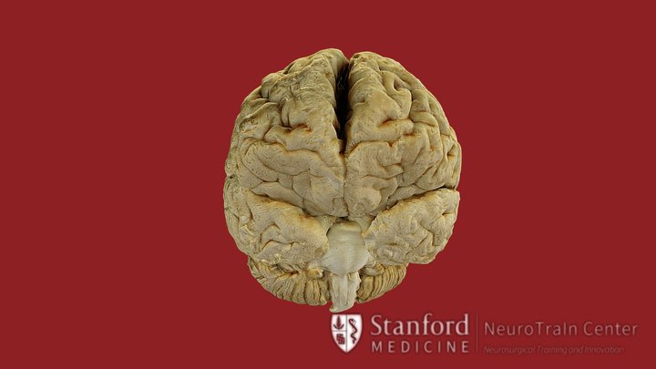 Brain 3D Model