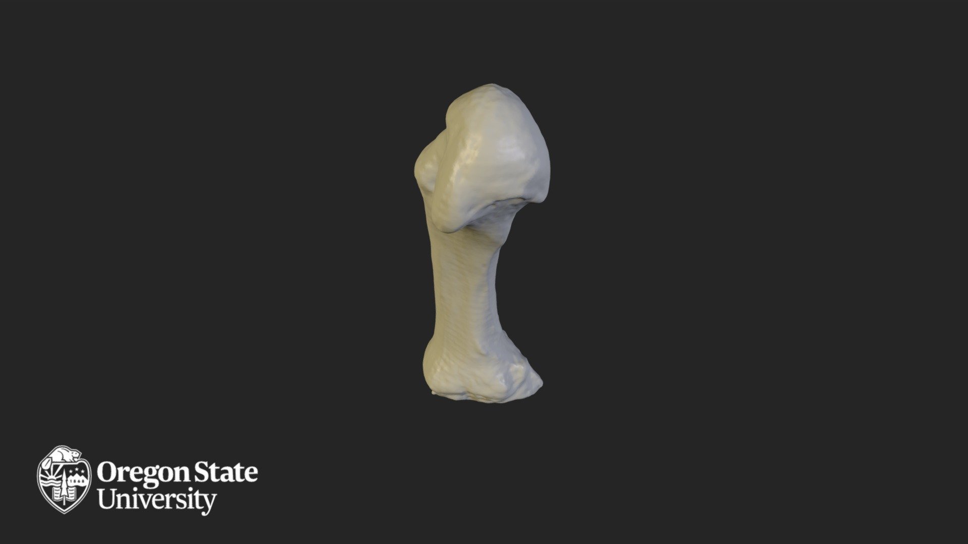 Metacarpal 2