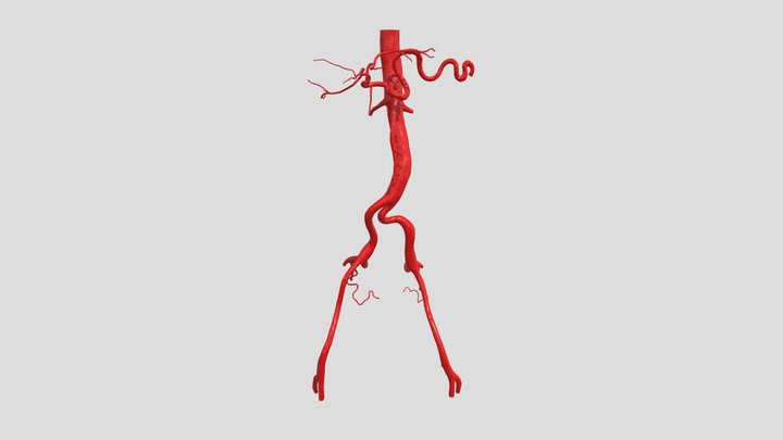 Abdominal aorta 3D Model