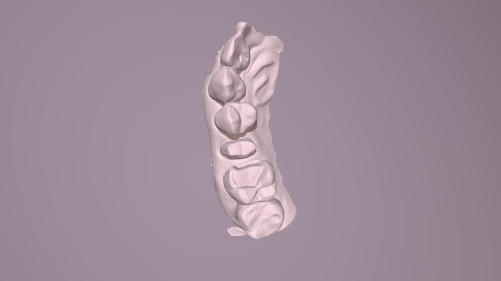 錦豐 Upper Jaw Scan 3D Model