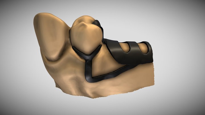 Y- Clasp 3D Model