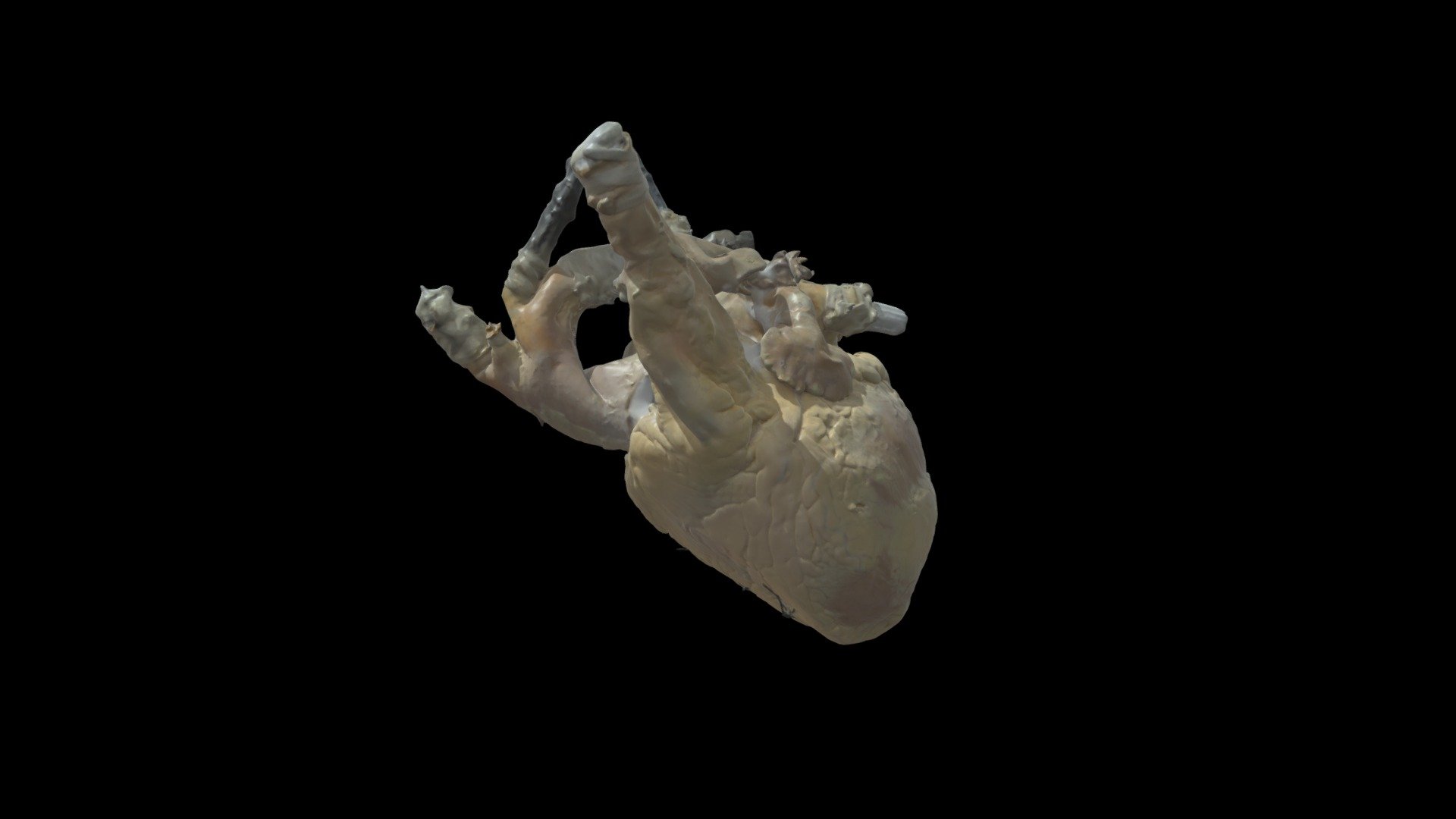 Human Heart #0494 External Anatomy - 3D model by VisibleHeartLabs ...