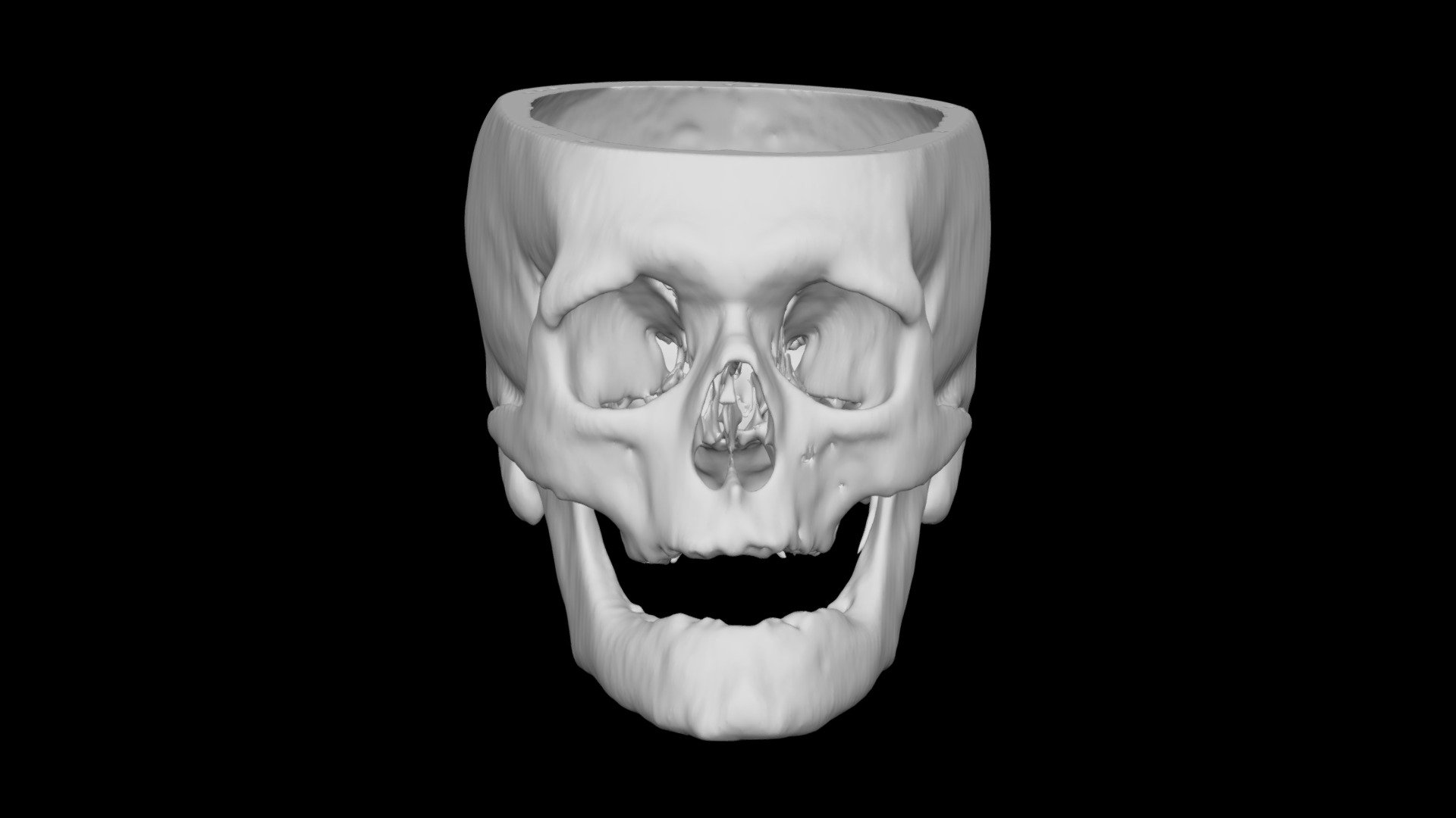 Skull Male 47yo