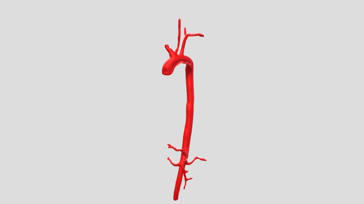 Aorta