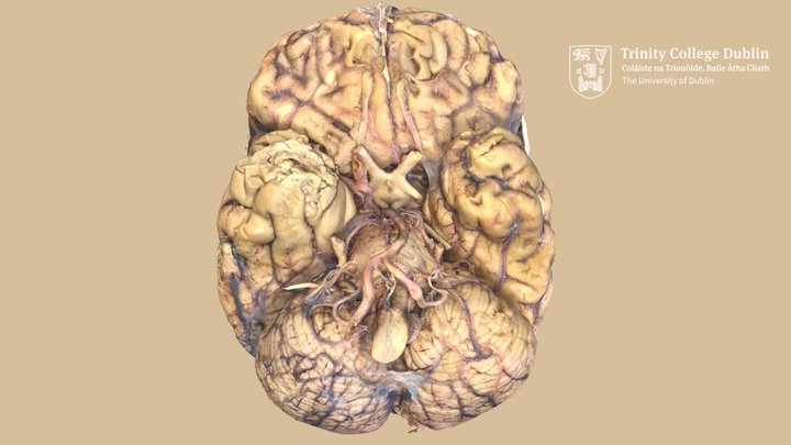 Circle of Willis 3D Model