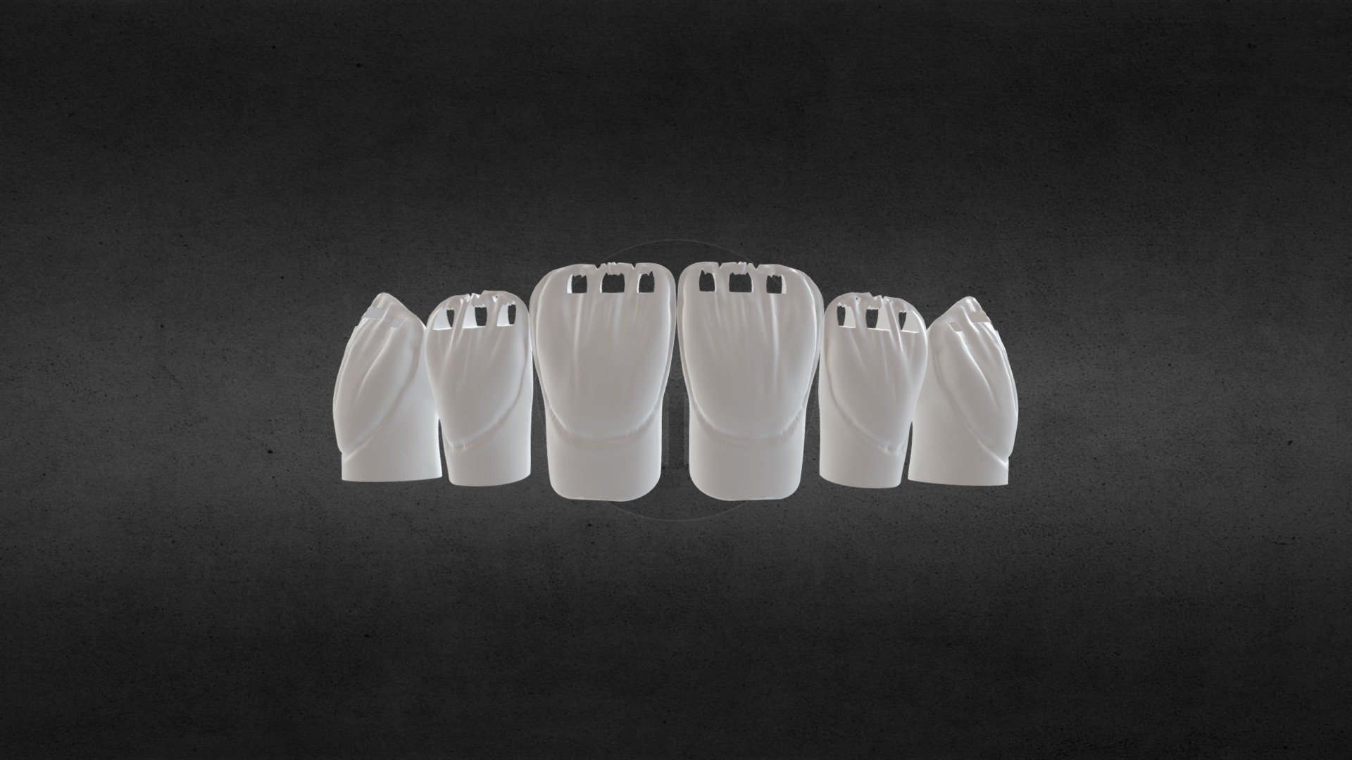 cutbackzirconia 3d printer 3D model by yasser199230 [31df8c5
