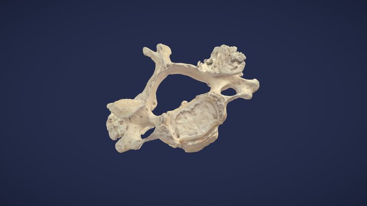 3. Halswirbel (C3) - 3rd cervical vertebra 3D Model