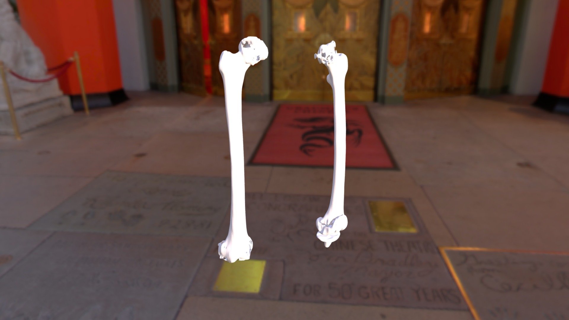 Femurs And Hardware
