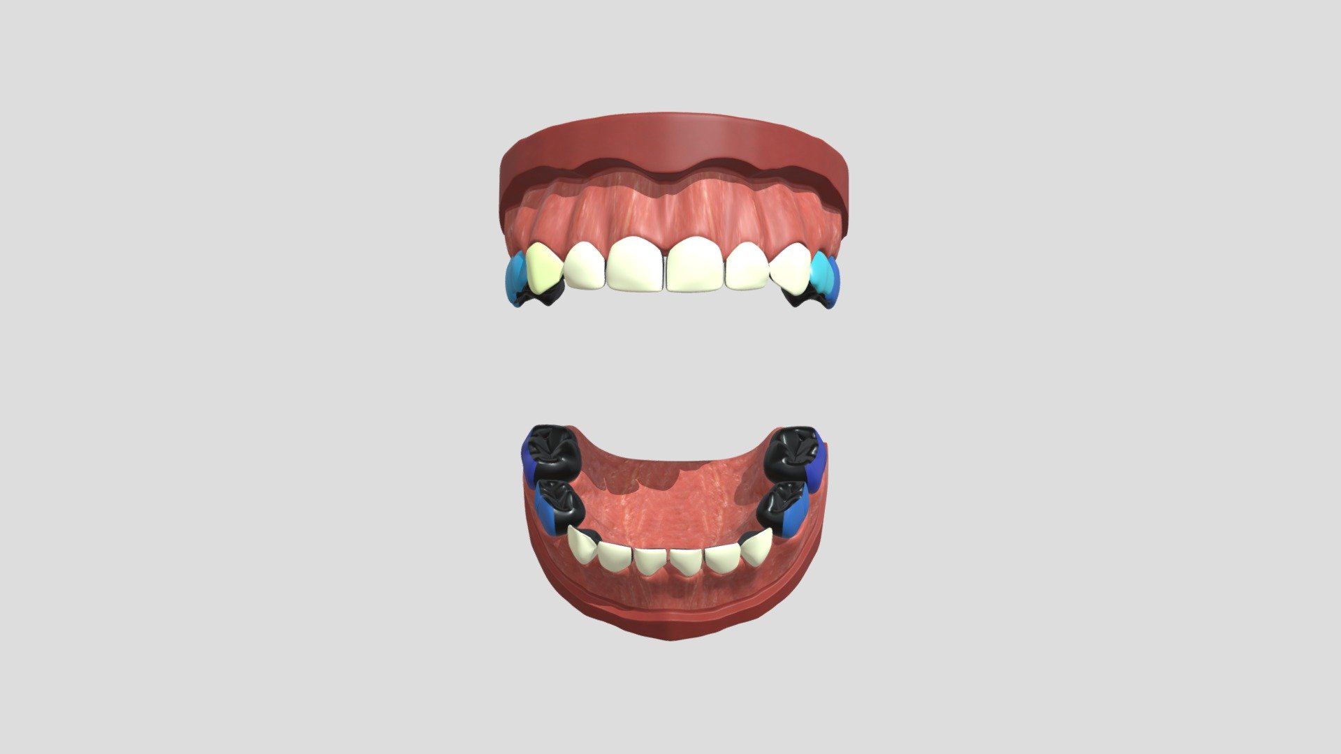 diff_nz_4cm_3c