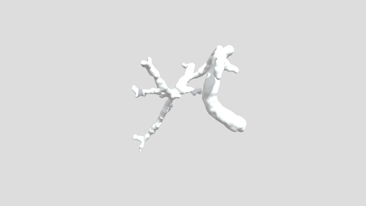 Right portal recalazitation 3D Model
