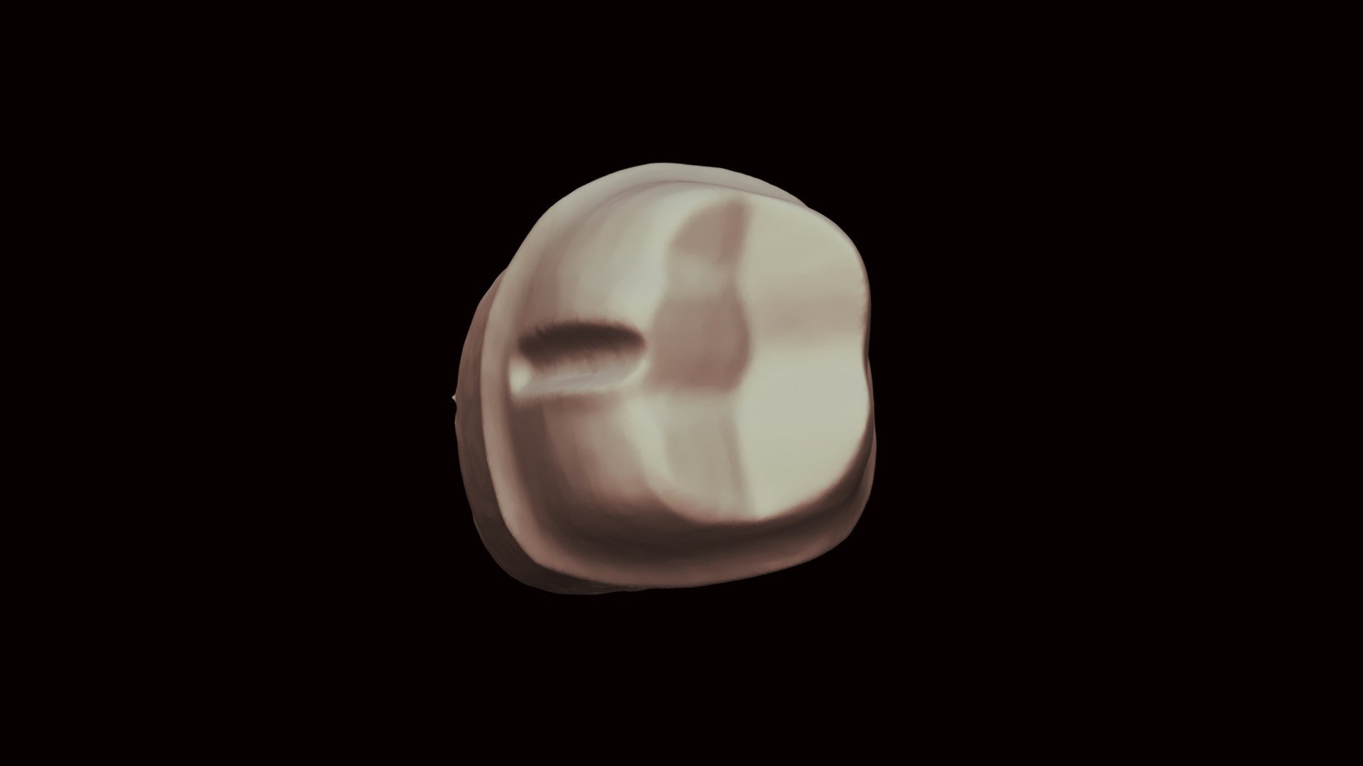 #30 Yellow Tooth Prep - 3D model by pkulkarni [334aab9] - Sketchfab