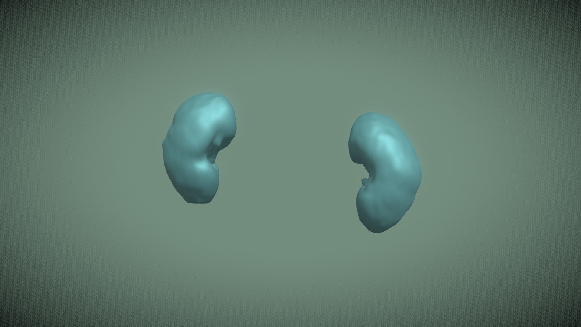 Segmentation Kidney