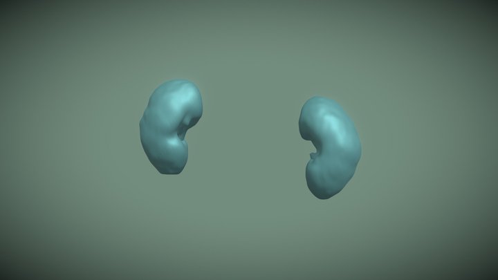 Segmentation Kidney 3D Model