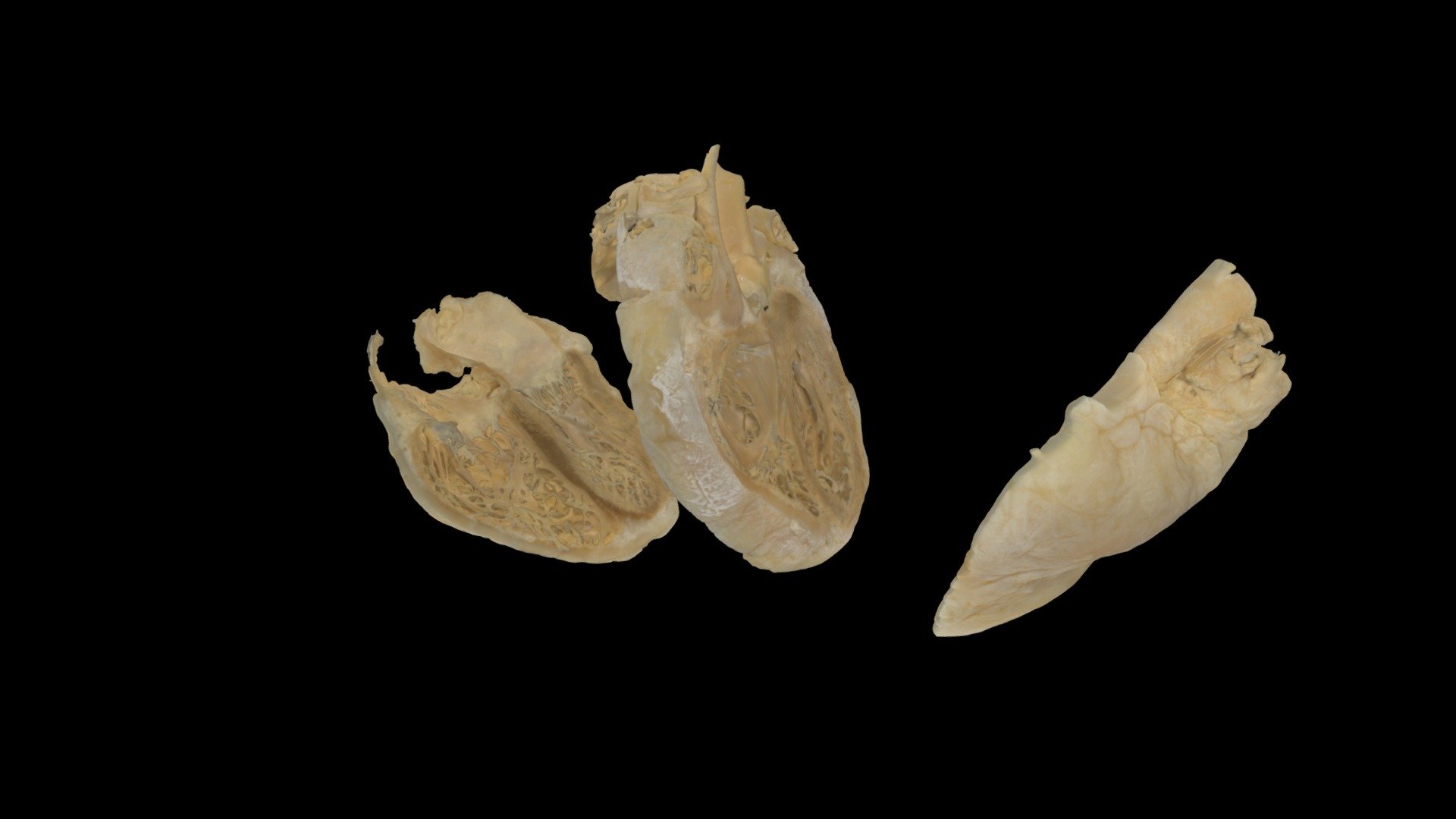Sliced Plastinated Heart0197
