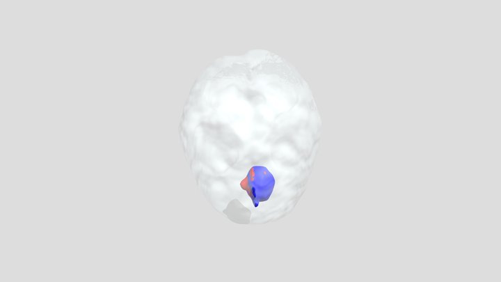 MRTumorModels 3D Model