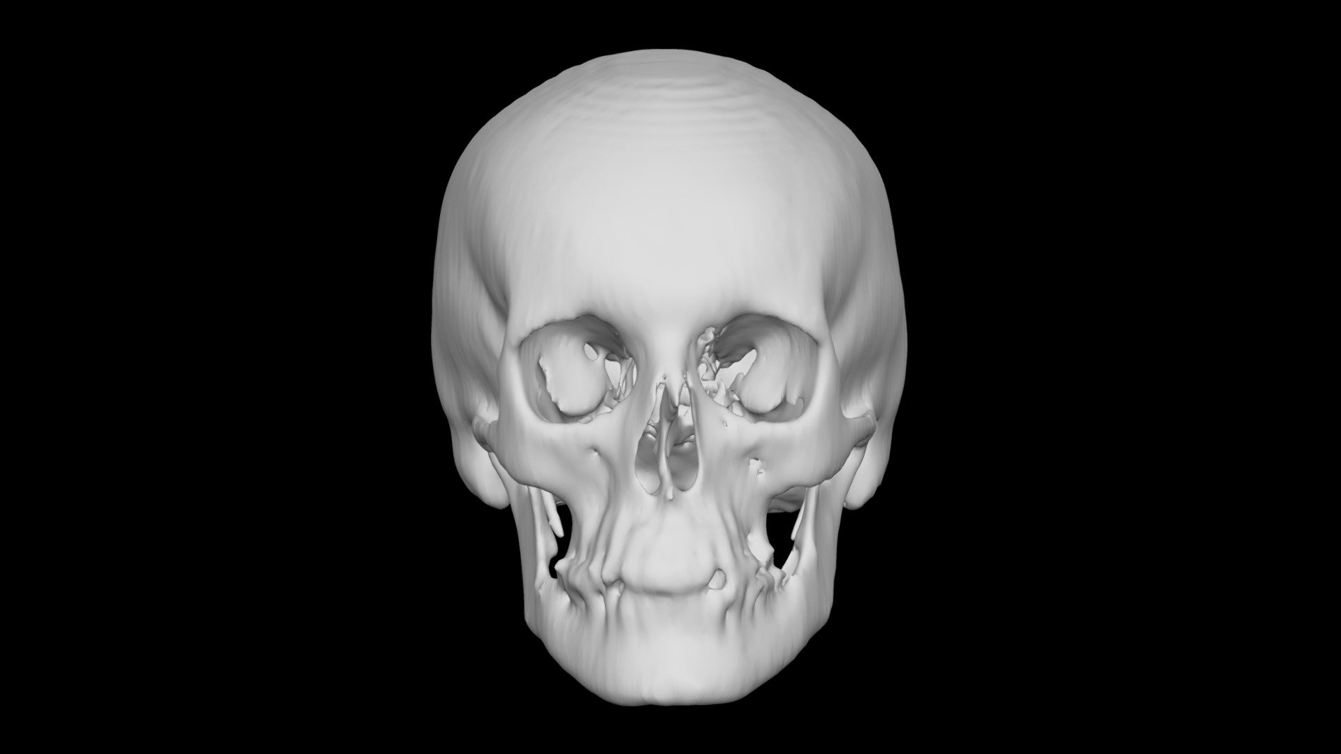 Skull Female 59yo