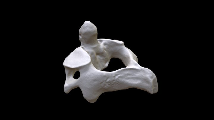 Human Axis C2 vertebra – Free 3D Model STL